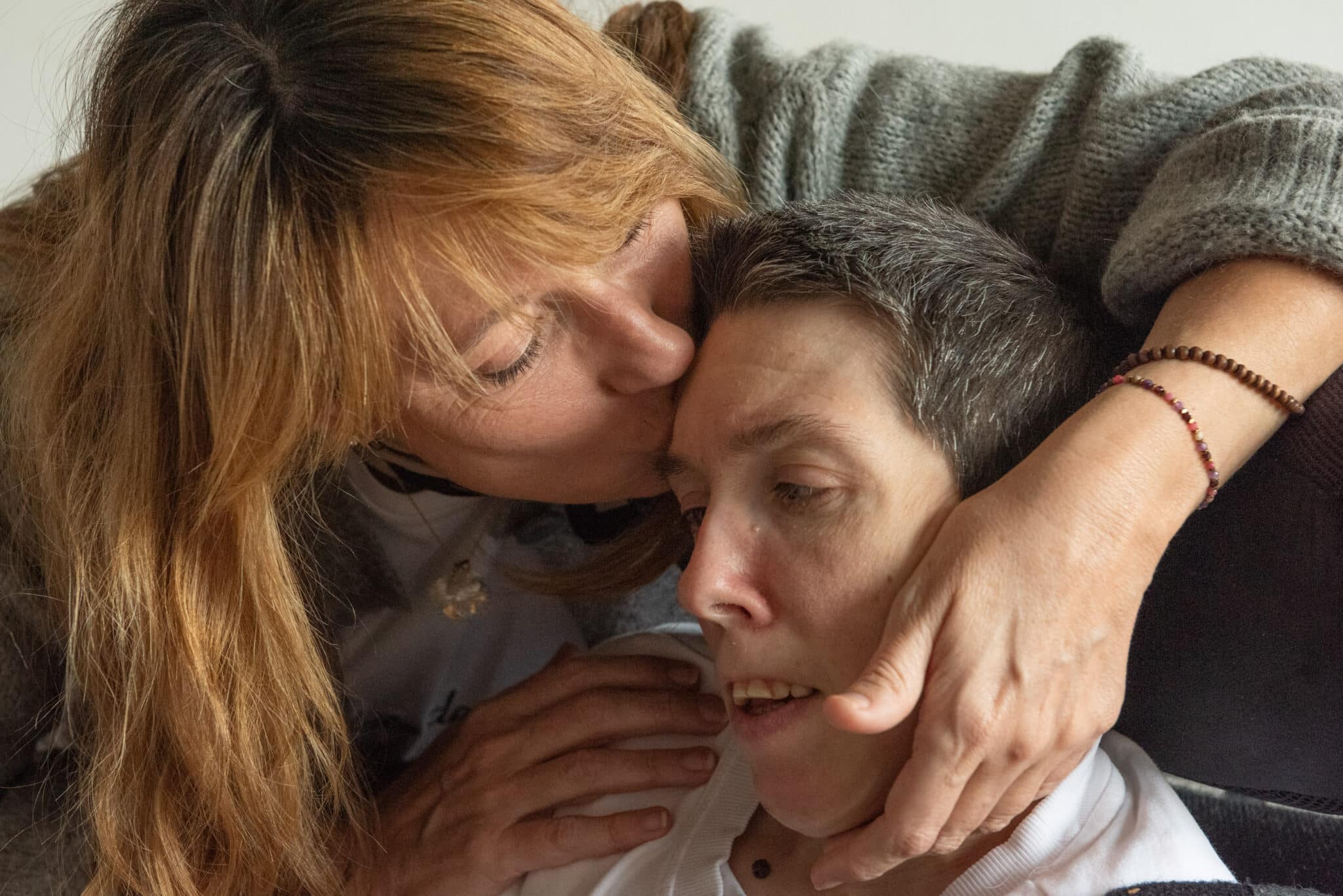 centro de día personas con discapacidad zona norte Madrid